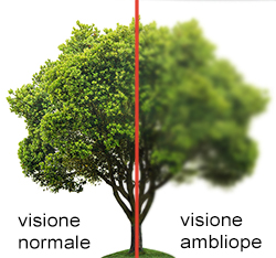 cura strabismo