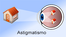 cura astigmatiscmo