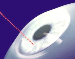 Eyeballing: ubriacarsi attraverso gli occhi. Un rischio per la vista